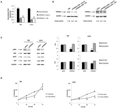 Knock-Down of Mucolipin 1 Channel Promotes Tumor Progression and Invasion in Human Glioblastoma Cell Lines